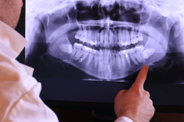 Best Emergency Treatment for Toothache in South Bend, WA