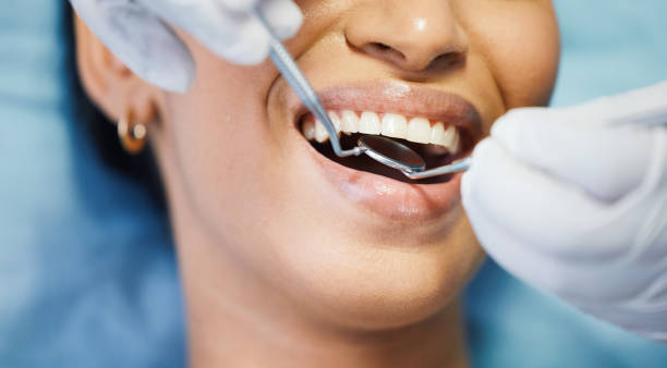 Best Walk-In Emergency Dentist in South Bend, WA
