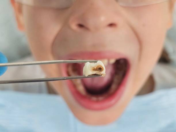 Best Emergency Orthodontic Repairs in South Bend, WA